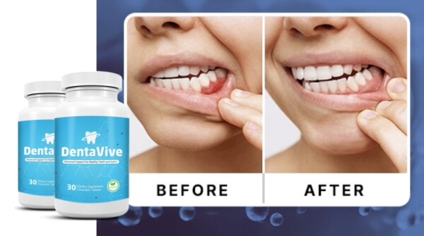 Hur man använder Dentavive